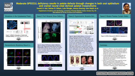 Everett G. Hall Nathan R. Wilson Luke Wenger Jeremy Goering Irfan Saadi K-INBRE website Everett G. Hall Nathan R. Wilson Luke Wenger Jeremy Goering Irfan Saadi K-INBRE website
